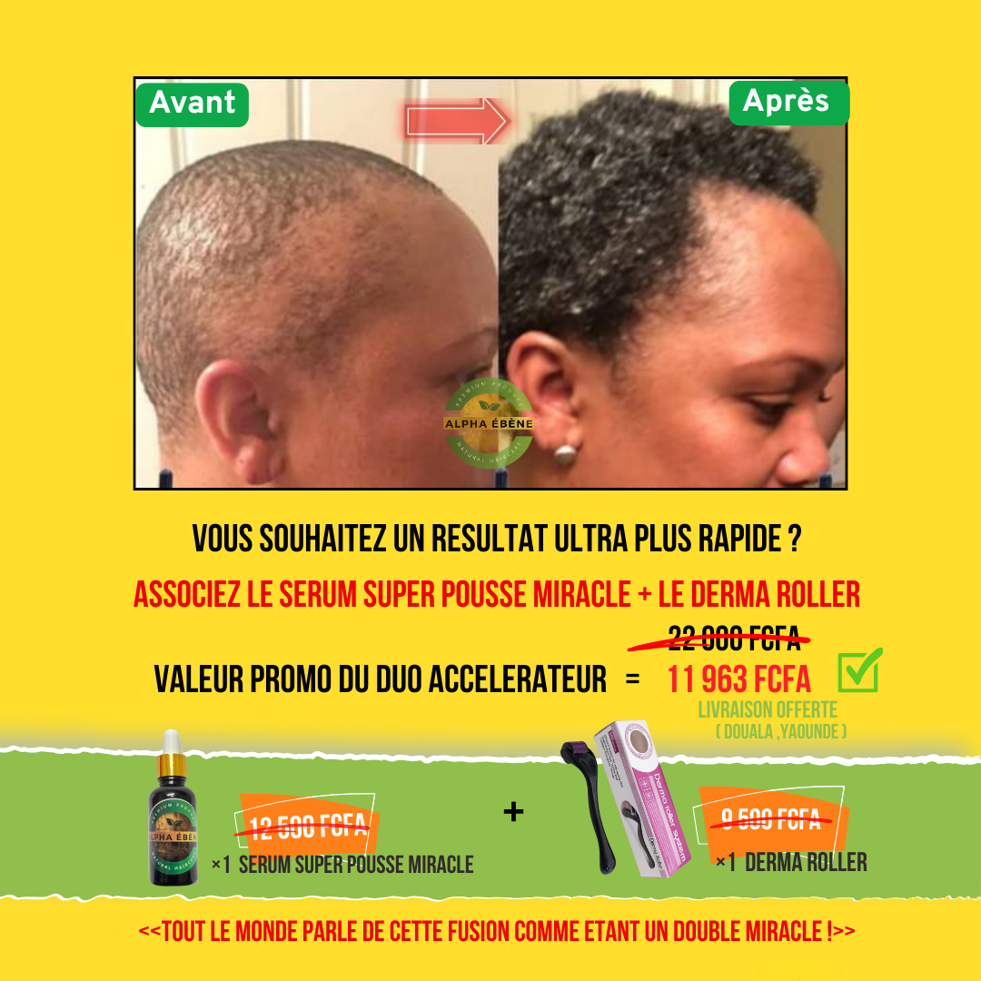 ALPHA ÉBÈNE – KIT ACCÉLÉRATEUR | Sérum Super Pousse + Derma Roller (Copie)