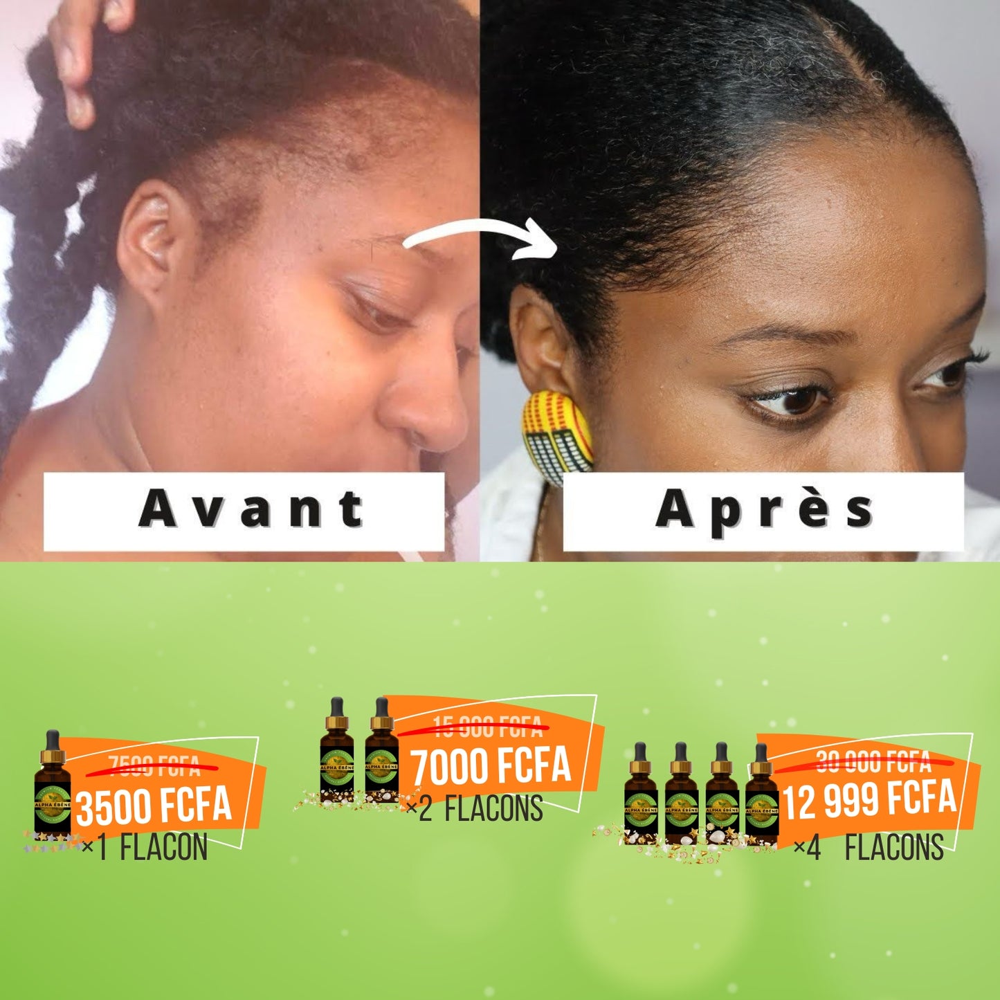 Huile Super Pousse Miracle - 100% Naturelle