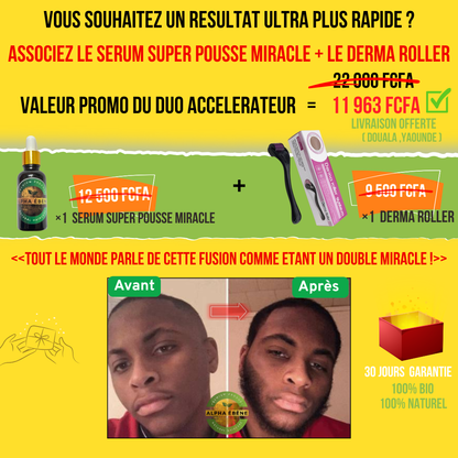 ALPHA ÉBÈNE – KIT ACCÉLÉRATEUR | Sérum Super Pousse + Derma Roller (Copie)