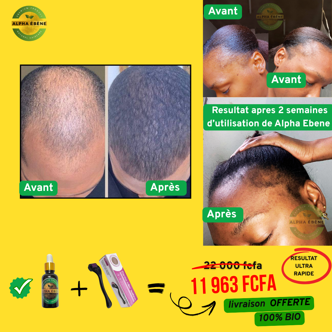 ALPHA ÉBÈNE – KIT ACCÉLÉRATEUR | Sérum Super Pousse + Derma Roller (Copie)