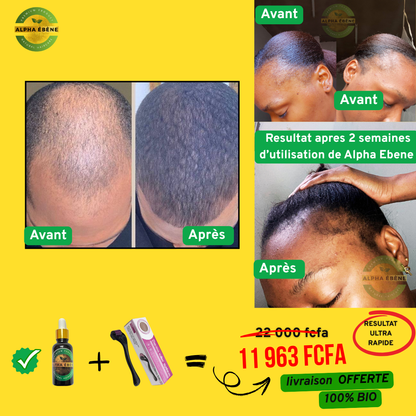 ALPHA ÉBÈNE – KIT ACCÉLÉRATEUR | Sérum Super Pousse + Derma Roller (Copie)
