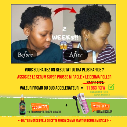 ALPHA ÉBÈNE – KIT ACCÉLÉRATEUR | Sérum Super Pousse + Derma Roller (Copie)