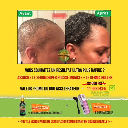 ALPHA ÉBÈNE – KIT ACCÉLÉRATEUR | Sérum Super Pousse + Derma Roller (Copie)
