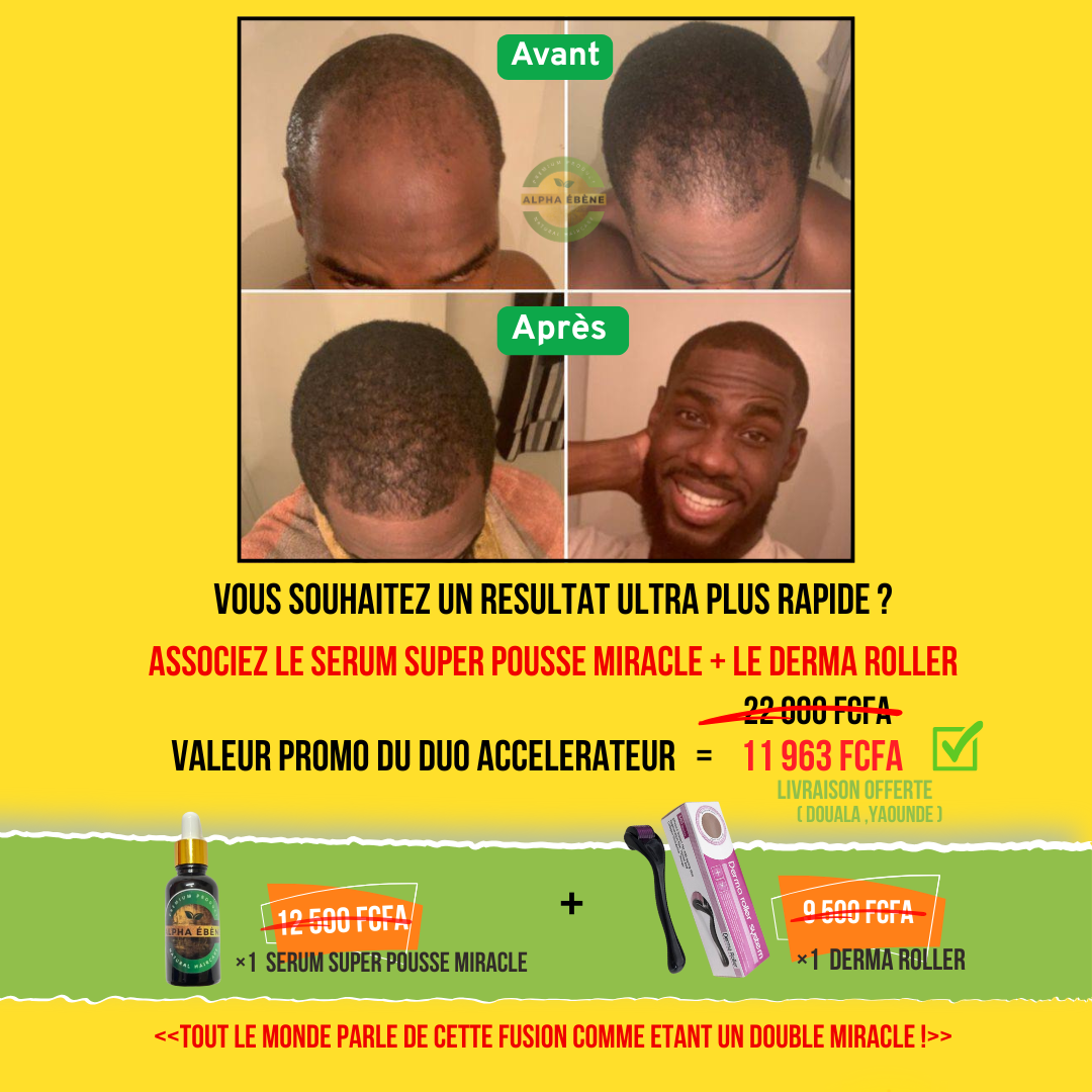 ALPHA ÉBÈNE – KIT ACCÉLÉRATEUR | Sérum Super Pousse + Derma Roller (Copie)