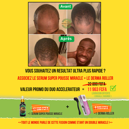 ALPHA ÉBÈNE – KIT ACCÉLÉRATEUR | Sérum Super Pousse + Derma Roller (Copie)