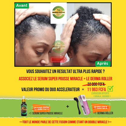 ALPHA ÉBÈNE – KIT ACCÉLÉRATEUR | Sérum Super Pousse + Derma Roller (Copie)