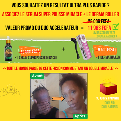 ALPHA ÉBÈNE – KIT ACCÉLÉRATEUR | Sérum Super Pousse + Derma Roller (Copie)