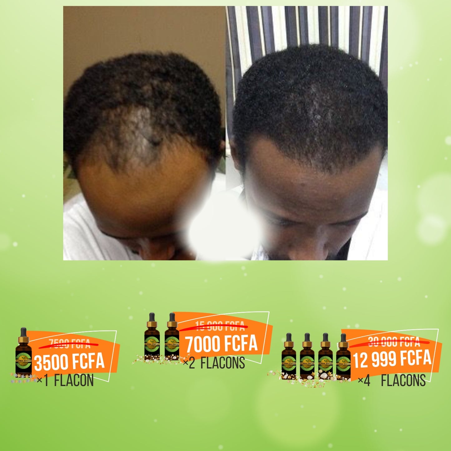 Huile Super Pousse Miracle - 100% Naturelle