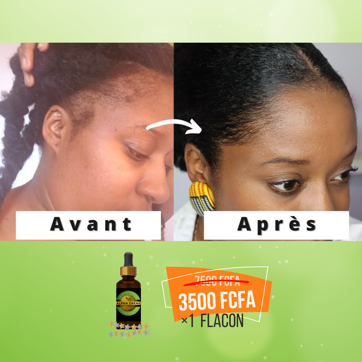 Huile Super Pousse Miracle - 100% Naturelle
