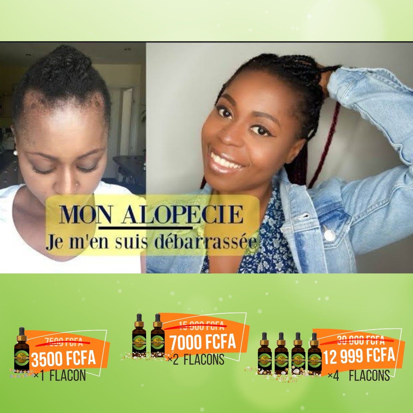Huile Super Pousse Miracle - 100% Naturelle